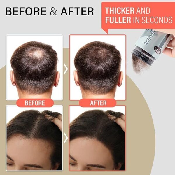 SMH Hair Fibers: Stunning Solution for Thinning Hair - Image 18